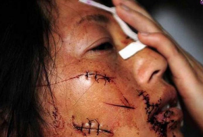 �ұ������c(di��n)���(y��n)���Ɉ�(zh��)��